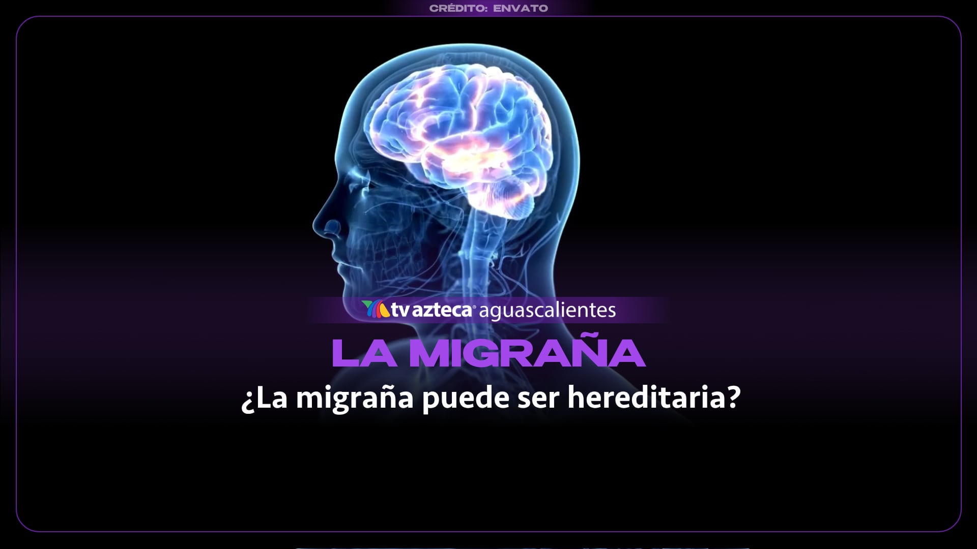 ¿La migraña se hereda de padres a hijos? Esto dice la ciencia